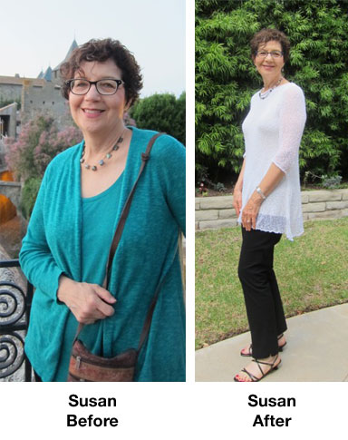 Susan Before and After